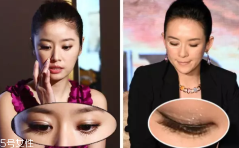 內(nèi)雙怎么進化成雙眼皮？全是雙眼皮貼的功勞