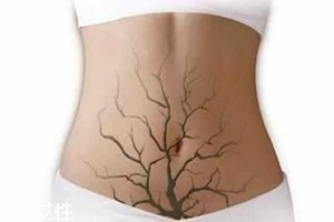 體內(nèi)毒素超標(biāo)有何表現(xiàn)？五大癥狀須注意