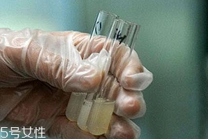 捐精有什么危害？專家稱沒有危害