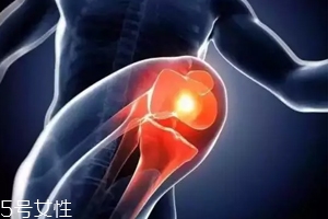 關(guān)節(jié)有響聲是病嗎？?jī)煞N情況區(qū)別對(duì)待