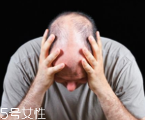 脫發(fā)有沒有治？只要不是禿子就有得治
