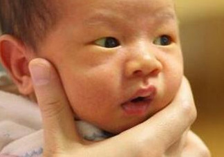 新生兒長黃疸怎么辦？有些黃疸癥狀媽媽們可別忽視