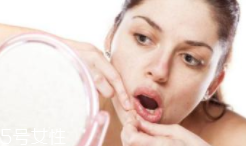 肌膚需要排毒嗎？長痘并不代表排毒