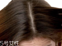 油性頭發(fā)跟什么有關(guān)？離不了這6個原因