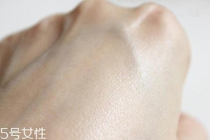 白癜風與身體免疫功能有關系嗎？兩者關系密切