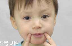 冬天爛嘴角什么原因？有可能營養(yǎng)不良