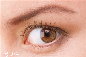 開(kāi)眼角會(huì)影響視力嗎？開(kāi)眼角會(huì)有危害