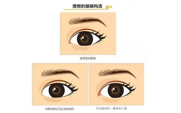 開外眼角和開內(nèi)眼角哪個(gè)好？開眼角有可能會(huì)回縮