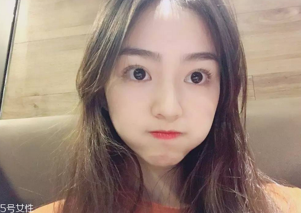 割雙眼皮要注意什么？割雙眼皮充血是正?，F(xiàn)象