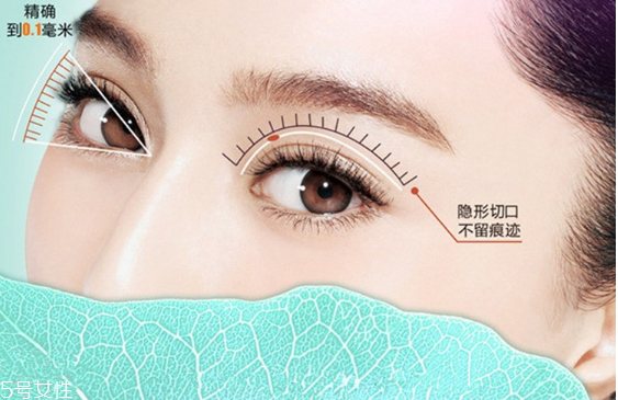 韓式雙眼皮是永久的嗎？圓眼睛不適合做雙眼皮