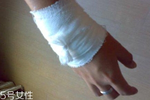被蜈蚣咬傷后能治愈嗎？科學家有新發(fā)現(xiàn)