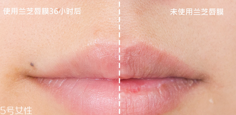 蘭芝唇膜吃進(jìn)去怎么辦？擁有水嫩嘴唇