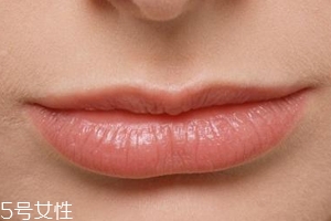 嘴唇干裂是一種病嗎？治療口角炎從改善習慣入手