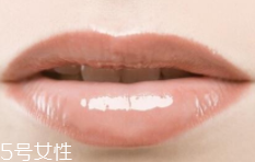 嘴唇干裂是一種病嗎？治療口角炎從改善習(xí)慣入手