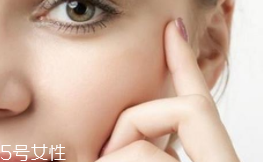 自然性的化妝品更安全嗎？警惕過敏源傷害肌膚