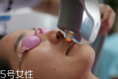 科技脫毛有哪些種類？冰點脫毛不毀毛囊