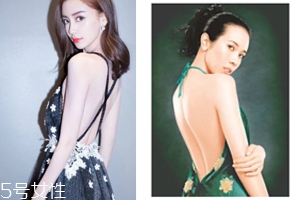 怎樣矯正背溝缺失？減肥運動是關(guān)鍵