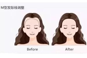 發(fā)際線粉填充和發(fā)際線筆哪個(gè)好？配合使用才最完美