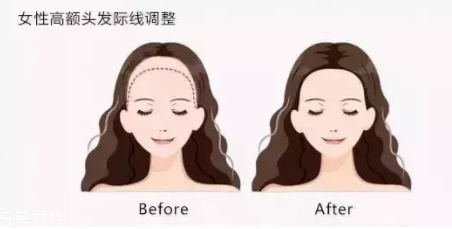 發(fā)際線粉填充和發(fā)際線筆哪個好？配合使用才最完美