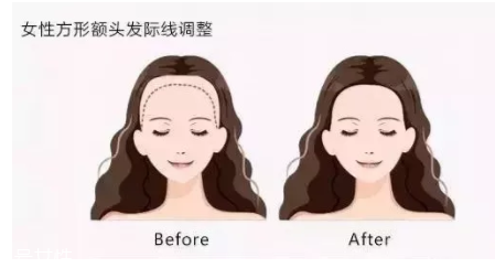 發(fā)際線粉填充和發(fā)際線筆哪個好？配合使用才最完美
