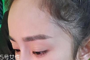 發(fā)際線高怎么治？拯救發(fā)際線攻略