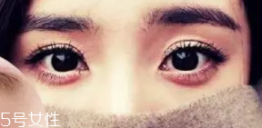臥蠶和眼袋的區(qū)別是什么？臥蠶是肌肉眼袋是肥肉