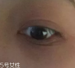 黑眼圈用什么眼霜好？多效護(hù)理型眼霜是首選