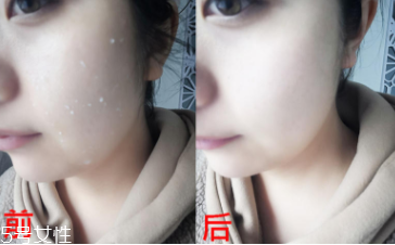 rosette去角質(zhì)凝膠怎么樣？真正的去角質(zhì)產(chǎn)品