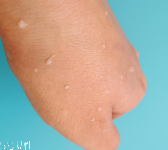 rosette去角質(zhì)凝膠怎么樣？真正的去角質(zhì)產(chǎn)品
