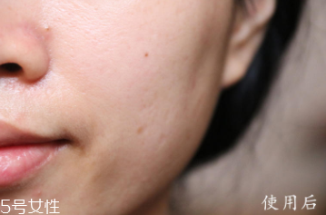 悅木之源和伊麗莎白雅頓哪個好？兩款精華大比拼
