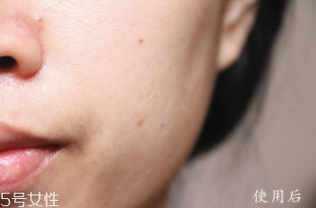 悅木之源和伊麗莎白雅頓哪個好？兩款精華大比拼