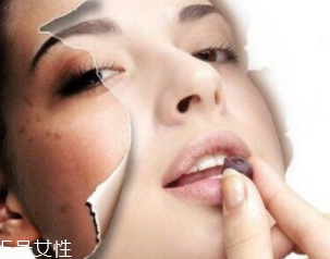 春季如何預(yù)防皮膚過(guò)敏？選擇敏感肌專用護(hù)膚品