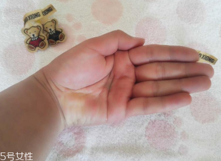 柳屋生發(fā)水有用嗎？一個(gè)月后長出新發(fā)