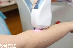 脫毛儀可以脫發(fā)際線嗎？脫了還會再長