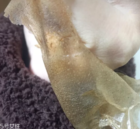 雪花秀撕拉面膜怎么撕出黑頭？這么做才能去黑頭