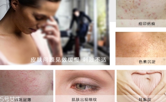 德國krauterhof蝸牛精華膏效果怎么樣？