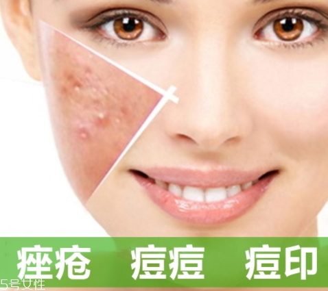 a酸怎么用？a酸怎么建立耐受？
