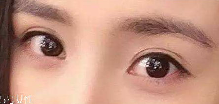 葉黃素能治療夜盲癥嗎？看什么類型的