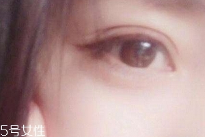 葉黃素一天吃多少毫克？按說明服用