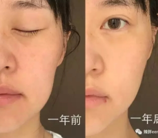 童顏機(jī)有用嗎？童顏機(jī)的功效