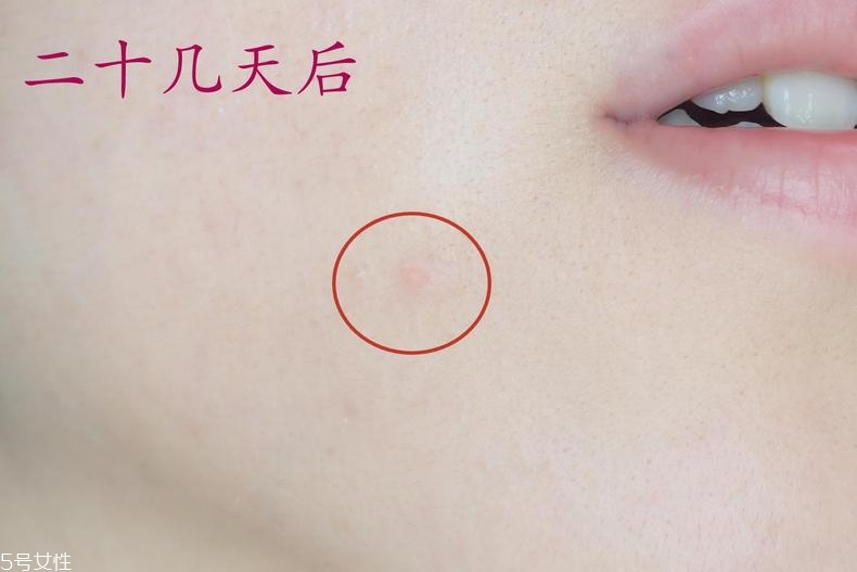 雅詩蘭黛晶透沁白防曬搖搖乳成膜快嗎？適合油痘皮嗎？