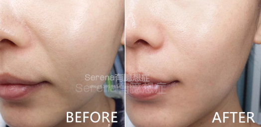 dermawand逆齡射頻注氧棒怎么用？