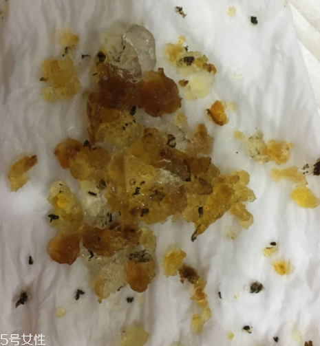 桃膠能和雞蛋一起吃嗎？桃膠配雞蛋可以嗎？