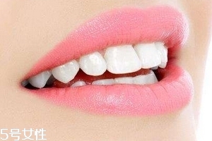 超聲波潔牙牙齒會變白嗎？超聲波潔牙心得