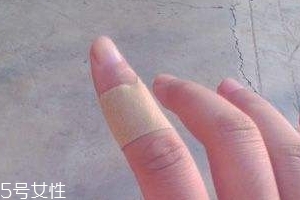 創(chuàng)可貼可以消腫嗎？創(chuàng)可貼有消腫功效嗎？