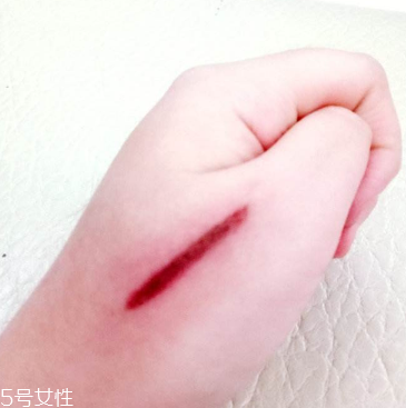 創(chuàng)可貼和肉連著怎么辦？創(chuàng)可貼連著肉怎么處理？