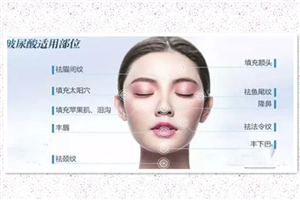 國(guó)產(chǎn)玻尿酸好嗎 國(guó)產(chǎn)玻尿酸哪些好