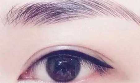 提眉和雙眼皮一起做嗎？提眉和雙眼皮要隔開多久