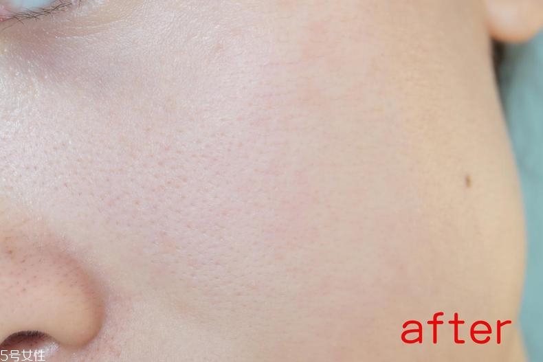 radha beauty vc精華白天能用嗎？敏感肌能用嗎？
