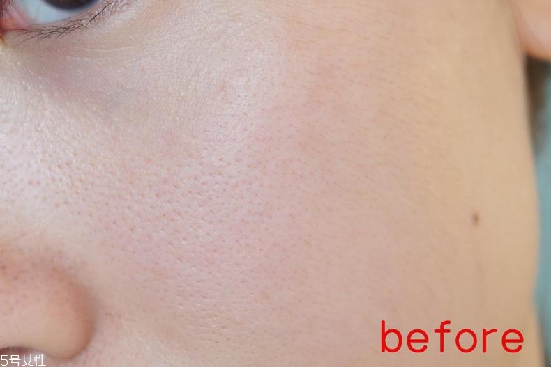 radha beauty vc精華白天能用嗎？敏感肌能用嗎？